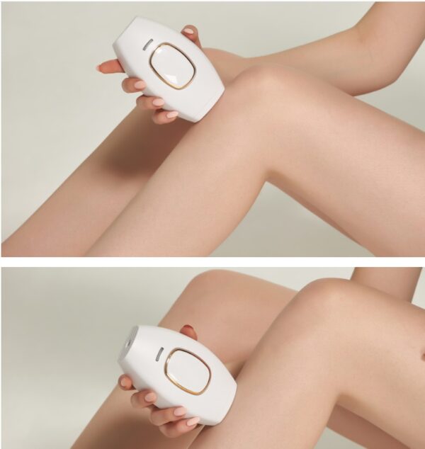 Household Whole Body Electric Hair Removal Equipment - Image 2