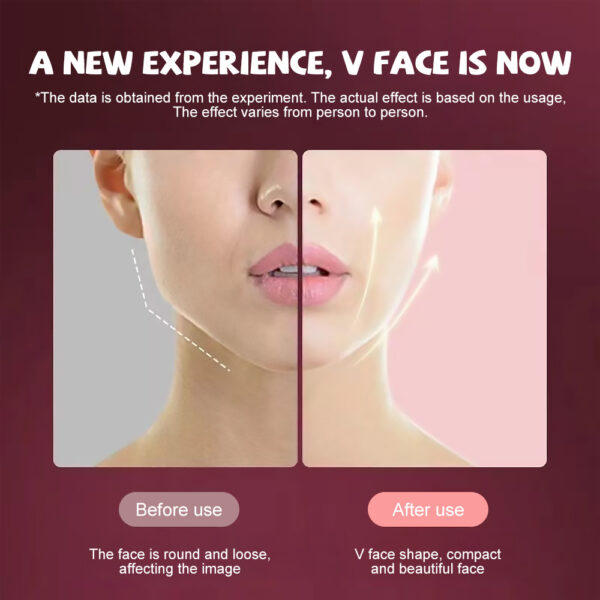 Microcurrent Face Massager EMS LED Photon Therapy V Shape Slimming Reduce Double Chin Remover Wrinkle Facial Lifting Device - Image 2