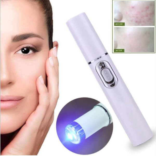 Acne Laser Pen Wrinkle Removal Machine Portable Durable Blue Light Therapy Massage Relax Soft Scar Dark Circles Remover Device - Image 4
