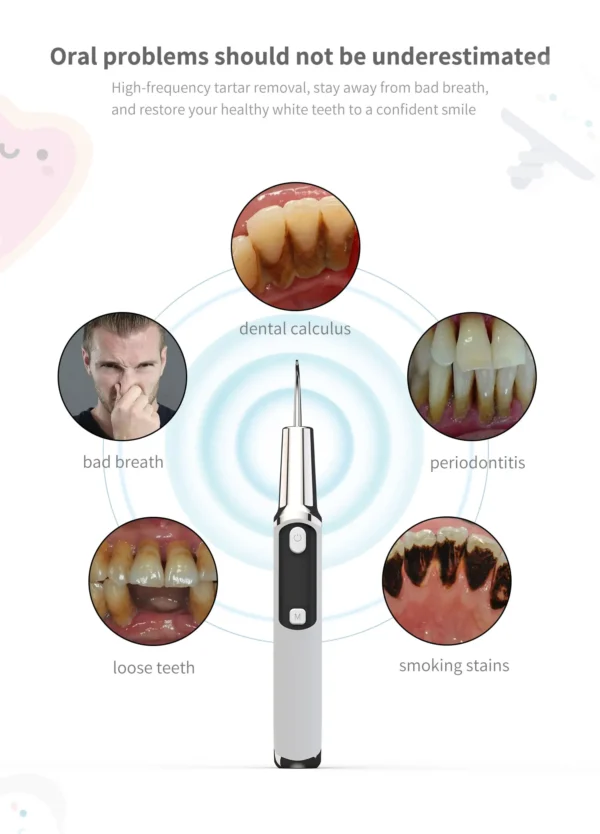 Dental Calculus Removal Ultrasonic Dental Calculus Scaler Ultrasound Dental Tartar Remover Electic Sonic Tooth Cleaner - Image 2