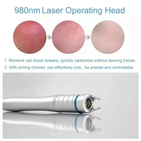 Hot Selling 980nm Diode Laser Machine for Commercial Use - Nail Fungus Treatment Varicose Veins Physiotherapy Lipolysis-2025 - Image 5