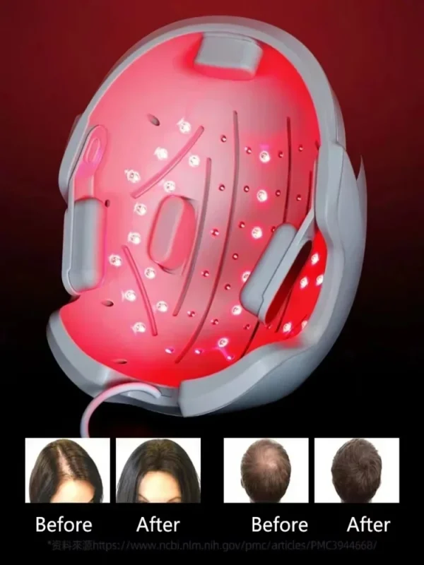 Lescolton Men Hair Growth Cap LLLT Helmet Laser Hair Regrowth Hair Loss Laser Treatment Hair Fast Growth Anti Hair Loss Machine - Image 2