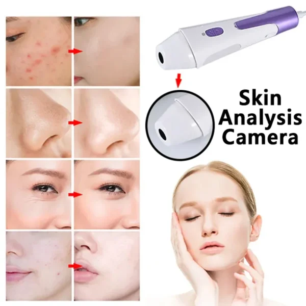 4 in 1 Facial CO2 Oxygen bubble hydro Dermabrasion Ultrasonic skin care spa equipment skin care aqua jet oxygen facial Machine - Image 6